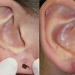 ear piercing cost in dubai