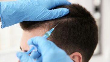 PRP Hair Therapy in Dubai