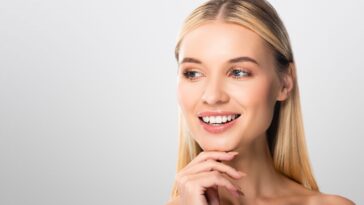 veneers before and after