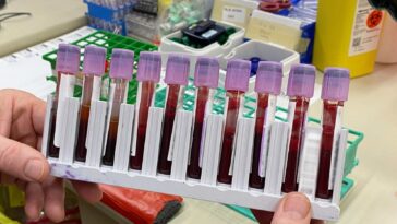 blood samples edit scaled e1649708222991