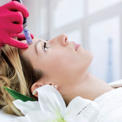 Is Microneedling Permanent for Acne Scars in Dubai Abu Dhabi