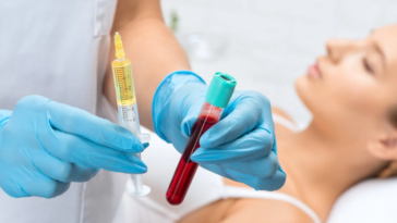 PRP Hair Therapy Cost in Dubai