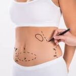 cost of GPS Laser Liposuction In Dubai