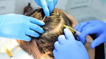 PRP Hair Therapy Cost in Dubai 4