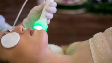 Hair Removal Service in Hamilton ON