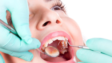 609c38fec0d9e64a4dd71c98 Periodontics Treatment