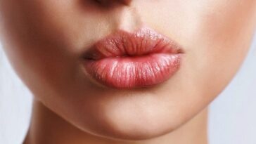 Laser Treatment for Dark Lips in Dubai Abu Dhabi Sharjah Cost