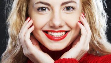 Botox for Gummy Smile