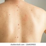 close detail bare skin