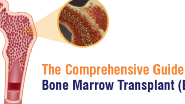 Bone Marrow Transplant BMT Main 1200x900 1