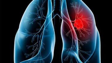 591b03c1 e6a4 4c04 8748 3c2825bbab96