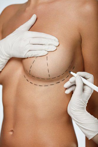 Breast Augmentation in Dubai 14