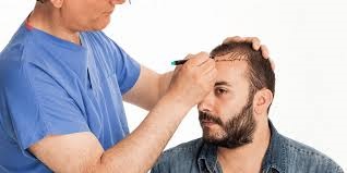 Hair Transplant Cost Riyadhh