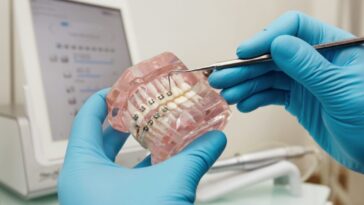 Orthodontic Treatment Know About Braces and Aligners 1024x683 1