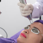 Fractional CO2 Laser for Skin Tightening 21 pic co2