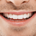 Who Can Benefit from Root Canal Procedures, Recovery, and Cost? 20 26