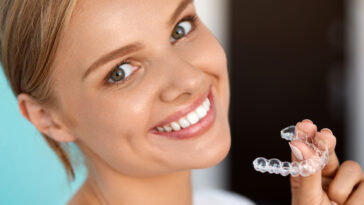Transform your smile with composite veneers for a flawless finish