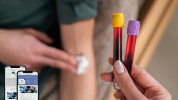 Blood Test Without GP Referral