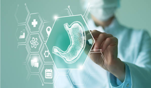 Understanding the Psychological Preparation for Bariatric Surgery 2 Understanding the Psychological Preparation for Bariatric Surgery 1