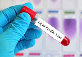 lipid test