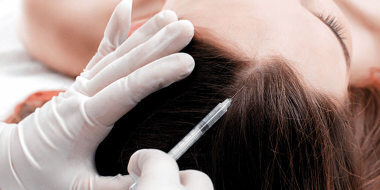 Boost hair growth naturally in Dubai with exosomes