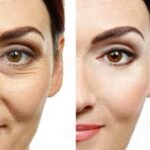 Revolutionizing Aesthetics: Plastic Surgery Trends in Riyadh 20 Plastic surgery in riyadhbbaa