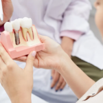 Dubai dental implant infection Timely treatment prevents issues