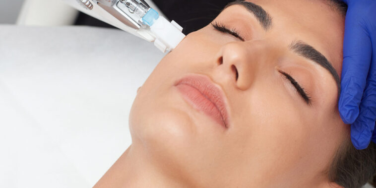Can skin boosters help with pigmentation? 1 V2 SKIN BOOSTER TREATMENT 1280x640 1