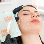 How to Maintain the Effects of Thread Lift Treatment