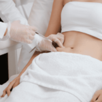 Revitalize Your Body with Adipose Lipolysis Injections 1