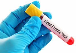 Lipid Profile Test