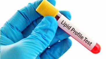 Lipid Profile Test