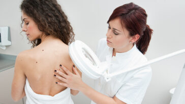 Breaking Myths About Acne and Its Treatments