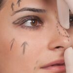 How Rhinoplasty Can Boost Your Confidence and Self Esteem