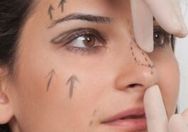 How Rhinoplasty Can Boost Your Confidence and Self Esteem