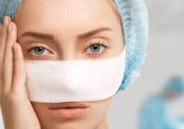 Rhinoplasty for Aging Noses Restoring Youthful Features