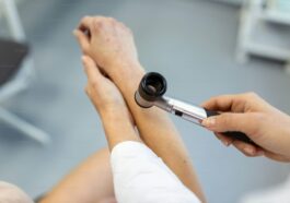 The Role of Dermatology in Hair Restoration and Hair Loss Treatments