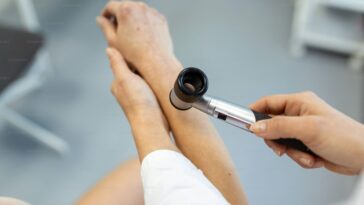 The Role of Dermatology in Hair Restoration and Hair Loss Treatments