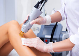 benefitsoflaserhairremoval