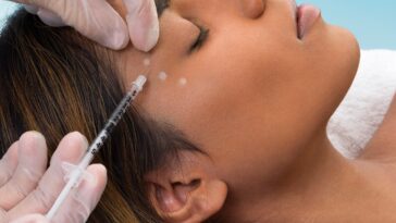 The Role of Botox in Facial Rejuvenation