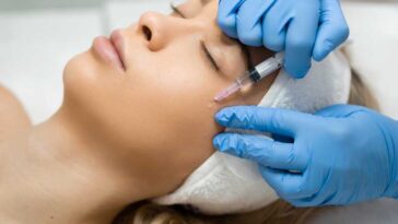 cheek filler dublin 1