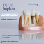 Who Provides the Best and Most Affordable Dental Implants in Camas, WA 21 Dental Implant
