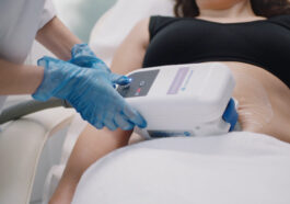 61d19d2ef9e0cafc1d9986cc coolsculpting 20dubai 4