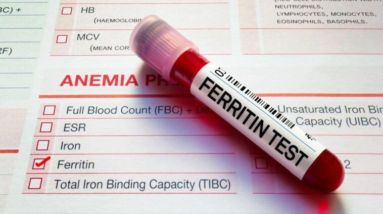 Ferritin Test