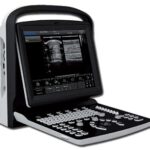 chison Eco 1 portable ultrasound machine