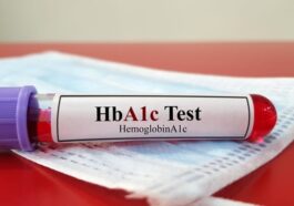 HbA1c Test