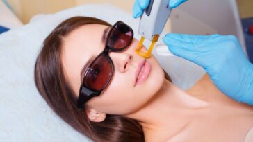 Laser Hair Removal