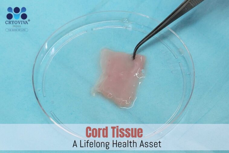 Preserving Cord Tissue