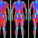 DEXA Body Composition Scan – Accurate Full-Body Analysis 20 BN JW632 0817ac 12S 20150817105701