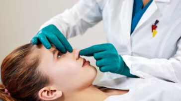 Rhinoplasty in Riyadh 9